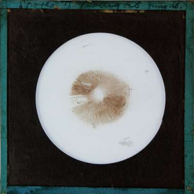 Lantern Slide: Spores of [illegible] Fungus