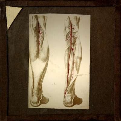 Lantern Slide: Blood vessels in lower leg