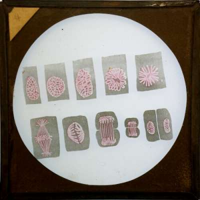 Lantern Slide: Unidentified physiological subject