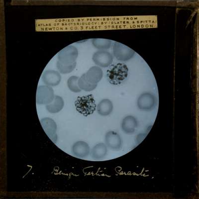 Lantern Slide: Benign Tertian Parasite, Mature segmented sporocyte, X 1,000, methylene blue
