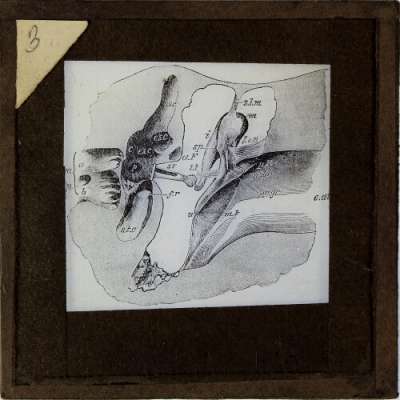 Lantern Slide: Profile view of the left membrane tympani and auditory ossicle
