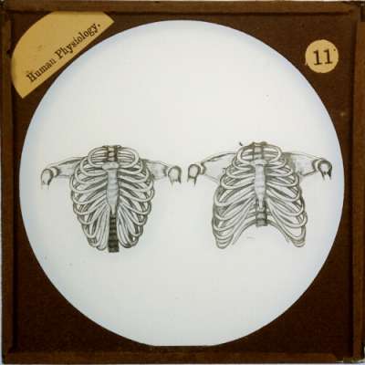 Lantern Slide: Effects of Tight Lacing on the form of the Skeleton