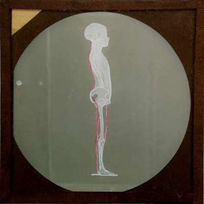 Lantern Slide: Posture of human body